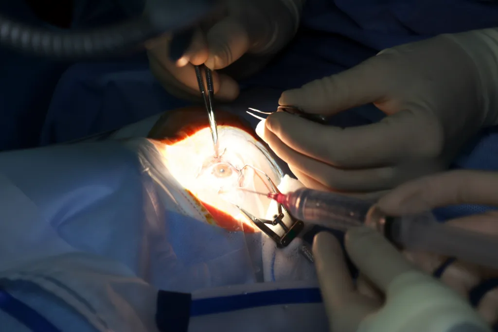 Oftalmólogos del Hospital Universitario de Torrejón advierten de las consecuencias de un mal cuidado de las lentes de contacto