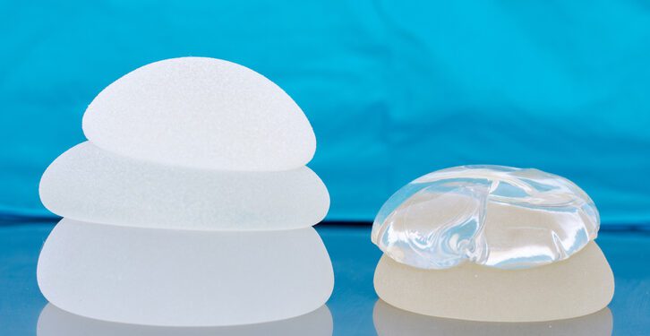 La OCU reclama judicialmente a Allergan más de 800.000 euros por las prótesis mamarias defectuosas 1 La OCU reclama judicialmente a Allergan más de 800.000 euros por las prótesis mamarias defectuosas