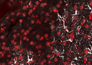 Crean una ‘linterna molecular’ que detecta la metástasis cerebral