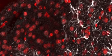Crean una ‘linterna molecular’ que detecta la metástasis cerebral