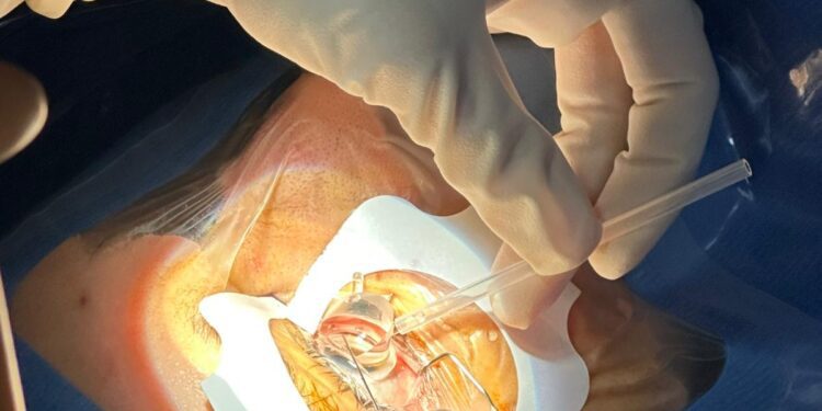 El Hospital Clínico de Valencia incorpora una nueva técnica láser para intervenciones de glaucoma 1 El Hospital Clínico de València incorpora una nueva técnica láser para intervenciones de glaucoma