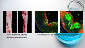 efecto aspartamo cell press