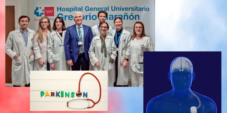 El Gregorio Marañón, primer centro público en España con neuroestimulación avanzada para el Parkinson