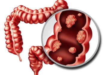 El Departamento de Salud del Vinalopó recuerda la importancia de participar en el programa de prevención de cáncer colon 1 El Departamento de Salud del Vinalopó recuerda la importancia de participar en el programa de prevención de cáncer colon