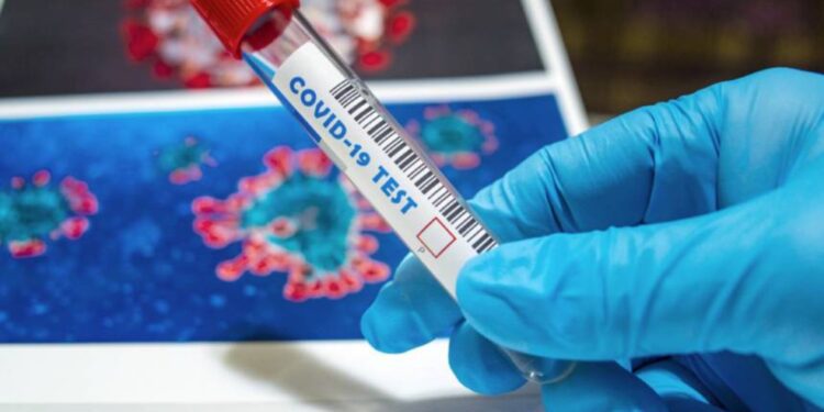 Alertan de los errores que contienen las bases de datos mundiales sobre el Covid 1 Alertan de los errores que contienen las bases de datos mundiales sobre el Covid