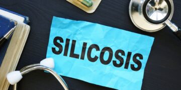 Resurge la silicosis en España con las encimeras de cuarzo