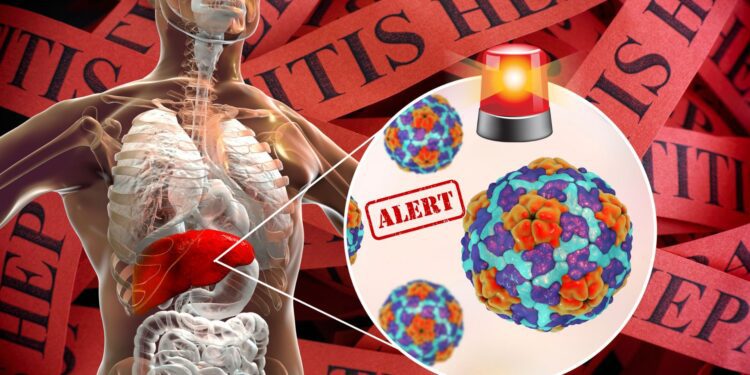 Alerta por el repunte de la hepatitis A en Europa, se recomienda estar atentos a los brotes importados 1 Alerta por el repunte de la hepatitis A en Europa, se recomienda estar atentos a los brotes importados