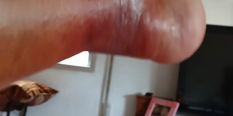 La araña violín: una plaga silenciosa en Náquera, Bétera y Serra 1 La araña violín: una plaga silenciosa en Náquera, Bétera y Serra