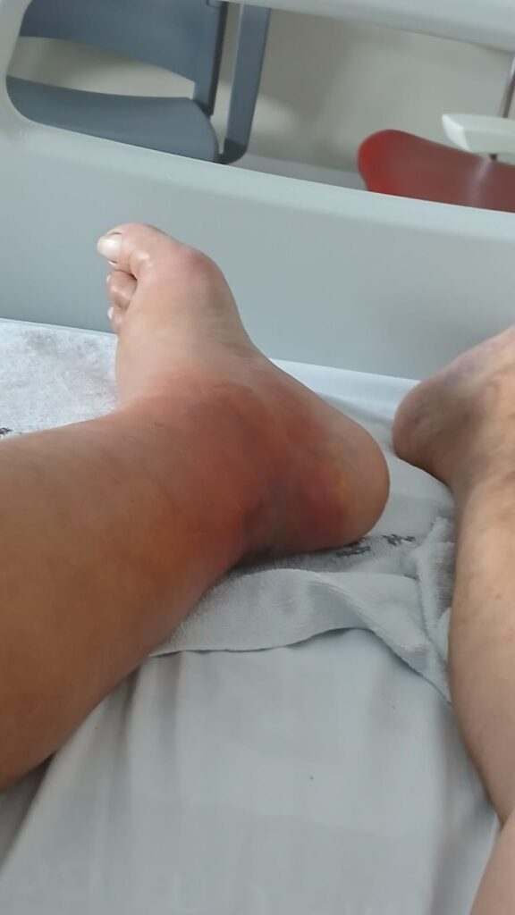 La araña violín: una plaga silenciosa en Náquera, Bétera y Serra 2 La arana violin una plaga silenciosa en Naquera Betera y Serra 2