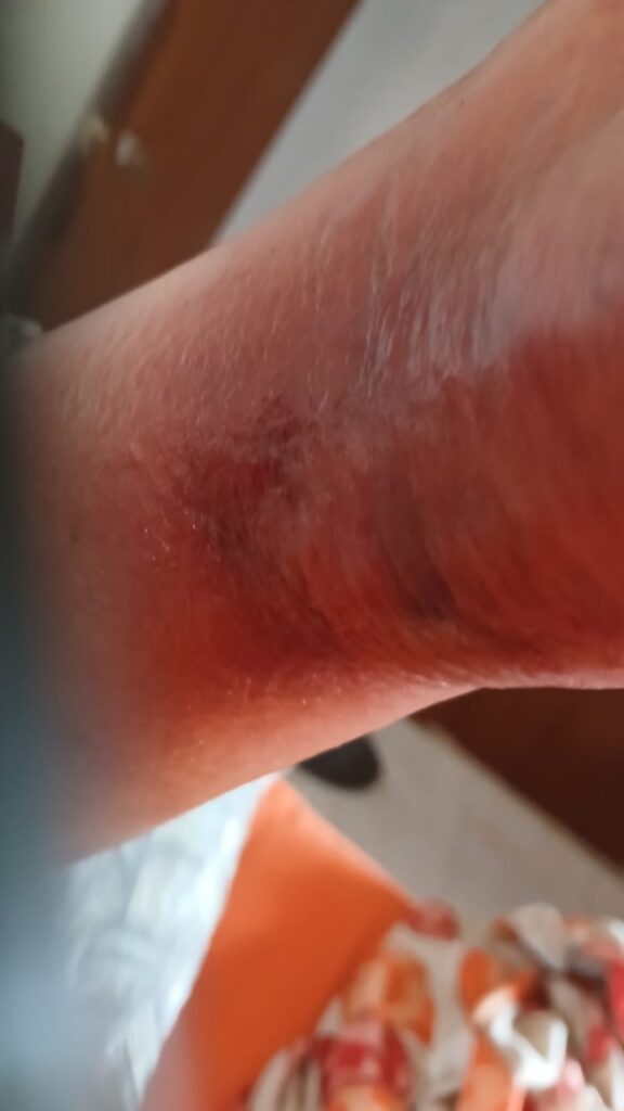 La araña violín: una plaga silenciosa en Náquera, Bétera y Serra 4 La arana violin una plaga silenciosa en Naquera Betera y Serra 4