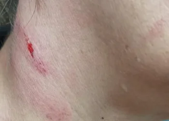 Brutal agresión a una funcionaria en la cárcel de Picassent: «Te tengo que matar»