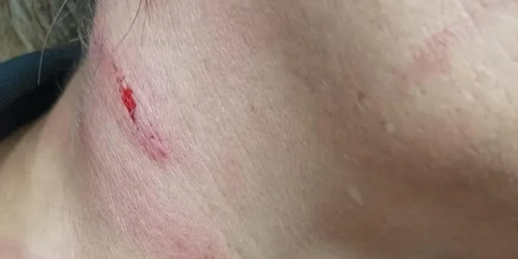 Brutal agresión a una funcionaria en la cárcel de Picassent: "Te tengo que matar" 1 Brutal agresión a una funcionaria en la cárcel de Picassent: «Te tengo que matar»