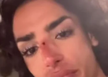 Un joven denuncia una agresión homófoba en Alicante: “Me acaban de tirar una botella por ser gay”