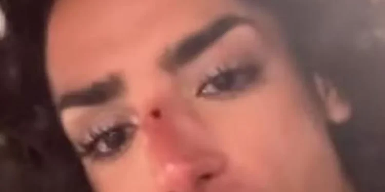 Un joven denuncia una agresión homófoba en Alicante: “Me acaban de tirar una botella por ser gay” 1 Un joven denuncia una agresión homófoba en Alicante: “Me acaban de tirar una botella por ser gay”