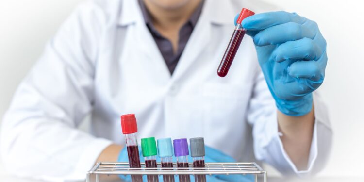 Gwada negativo: el grupo sanguíneo más raro del mundo