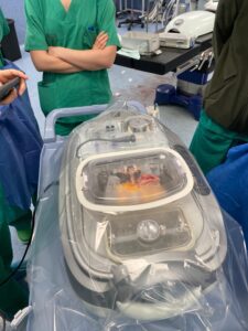 250801 SAN FOTO2 PerfusionRinon HospPeset