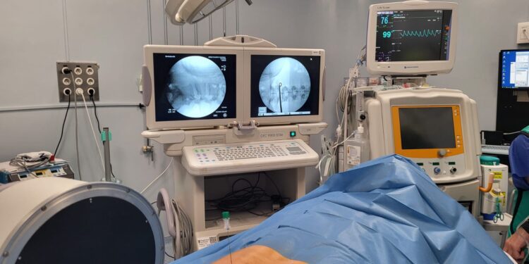 La Unidad del Dolor del departamento Arnau de Vilanova-Llíria incorpora una técnica mínimamente invasiva para tratar hernias discales 1 La Unidad del Dolor del departamento Arnau de Vilanova-Llíria incorpora una técnica mínimamente invasiva para tratar hernias discales