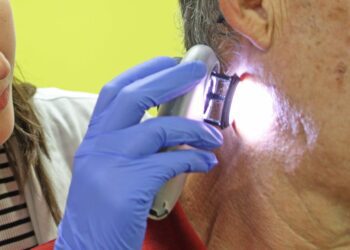 Cómo prevenir y tratar las manchas solares y otras afecciones cutáneas que aumentan en verano