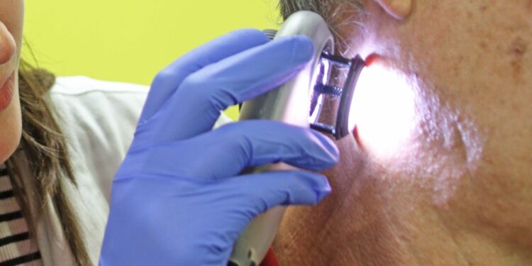 Cómo prevenir y tratar las manchas solares y otras afecciones cutáneas que aumentan en verano