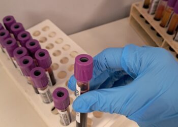 La CV cuenta con más de 43.500 donantes de médula ósea y con cerca de 5.000 unidades de cordón umbilical 6 La CV cuenta con más de 43.500 donantes de médula ósea y con cerca de 5.000 unidades de cordón umbilical