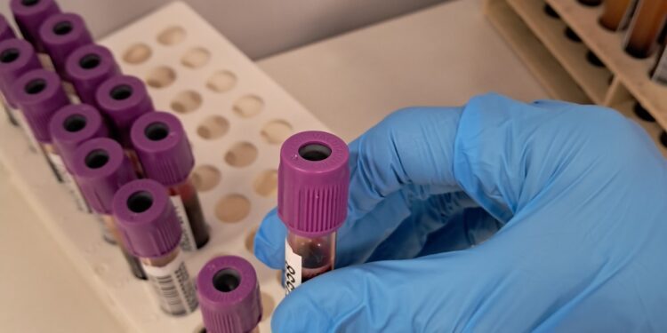 La CV cuenta con más de 43.500 donantes de médula ósea y con cerca de 5.000 unidades de cordón umbilical 1 La CV cuenta con más de 43.500 donantes de médula ósea y con cerca de 5.000 unidades de cordón umbilical