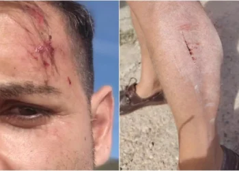 Agresión a un cámara y redactor de À Punt en Alcalá de Chivert