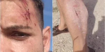 Agresión a un cámara y redactor de À Punt en Alcalá de Chivert