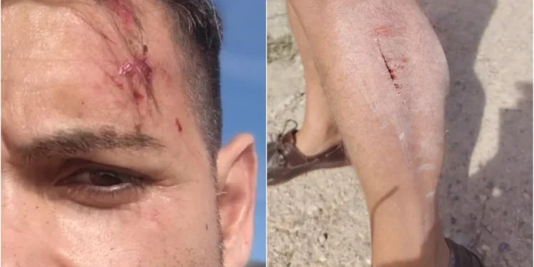 Agresión a un cámara y redactor de À Punt en Alcalá de Chivert