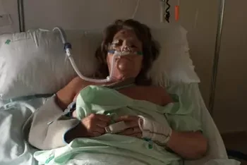 Una mujer de 62 años ingresa en la UCI tras la presunta agresión para robarle el patinete en Valencia