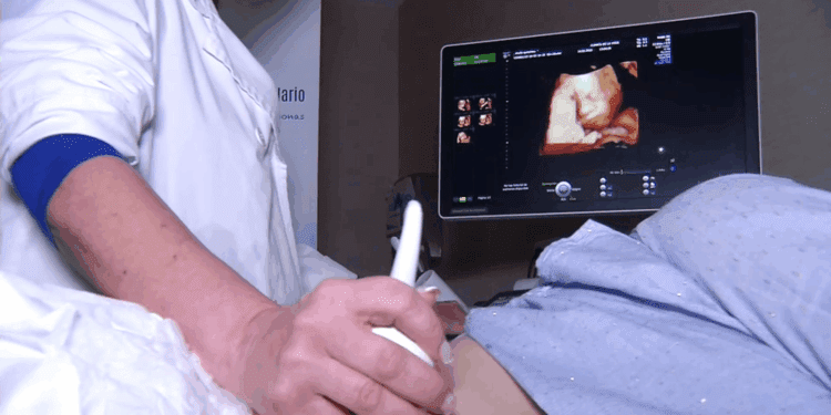 Expertos alertan del aumento de abortos en menores de edad en España