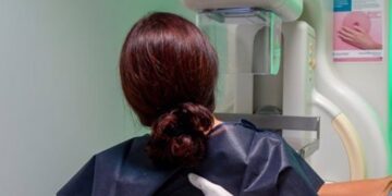Sanidad garantiza que los resultados de las mamografías del programa de cribado se entregarán en un máximo de 30 días