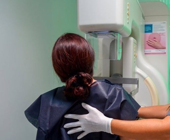 Sanidad garantiza que los resultados de las mamografías del programa de cribado se entregarán en un máximo de 30 días 1 Sanidad garantiza que los resultados de las mamografías del programa de cribado se entregarán en un máximo de 30 días