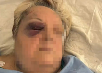 Una mujer de 71 años, brutalmente agredida en plena calle en Campanar tras un intento de robo