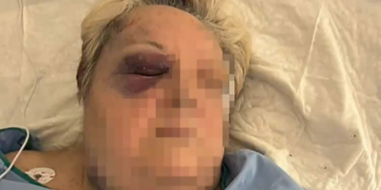 Una mujer de 71 años, brutalmente agredida en plena calle en Campanar tras un intento de robo 1 Una mujer de 71 años, brutalmente agredida en plena calle en Campanar tras un intento de robo