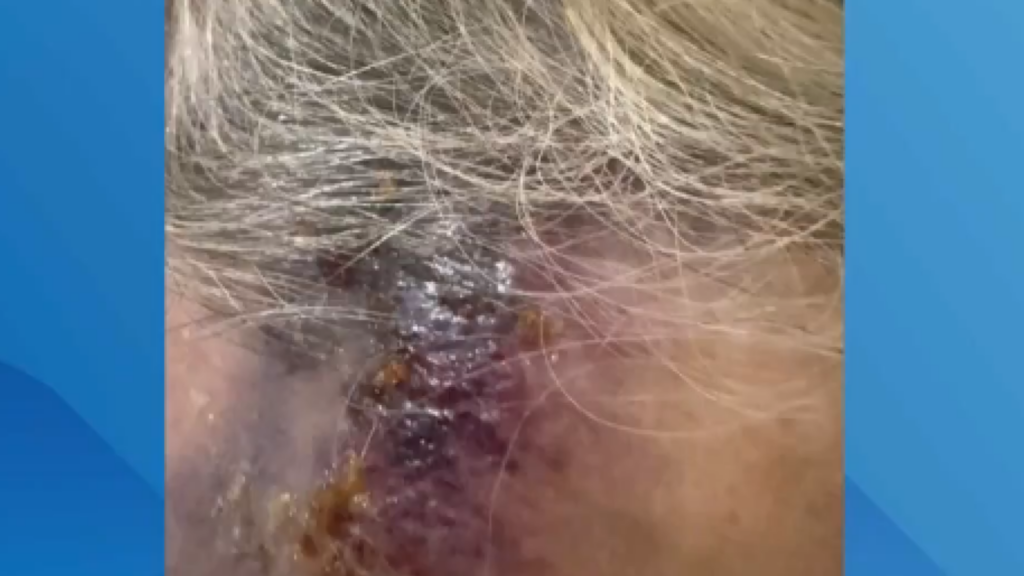 Una mujer de 71 años, brutalmente agredida en plena calle en Campanar tras un intento de robo 5 Brutal agresion a una mujer de 71 anos en Campanar dos individuos en patinete la golpearon hasta dejarla inconsciente 3