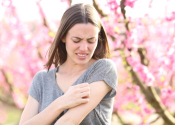 Experto de Vithas alerta sobre cómo prevenir los brotes de dermatitis que se agravan en primavera
