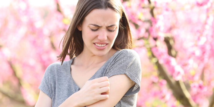 Experto de Vithas alerta sobre cómo prevenir los brotes de dermatitis que se agravan en primavera
