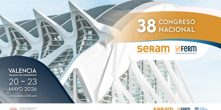 El cribado de cáncer de pulmón: el pilar radiológico que busca salvar miles de vidas en España