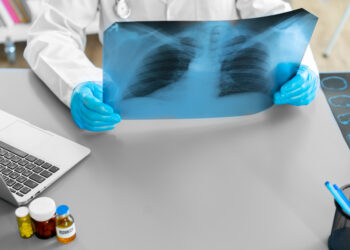 Un nuevo decálogo médico busca frenar el infradiagnóstico del Déficit de Alfa-1 Antitripsina (DAAT)