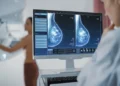 La Comunitat Valenciana participará en el primer estudio nacional para personalizar la prevención del cáncer de mama 10 c6ec2d54 486d 4b89 9819 15d500bcccf6 16 9 aspect ratio 1600w 0