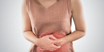 Expertos de Vithas alertan del aumento de intoxicaciones alimentarias en verano y recuerdan cómo prevenirlas